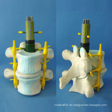 Medizinische Lehre Menschliches Spinal Skelett Vergrößertes Modell (R140104)